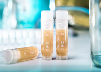 Bu ölkələrə səyahət edəndə virusa yoluxa bilərsiniz – Diqqət