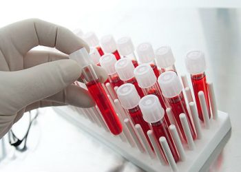 Qeyri-ənənəvi həyat tərzi keçirən qadınlar müayinə ediləcək